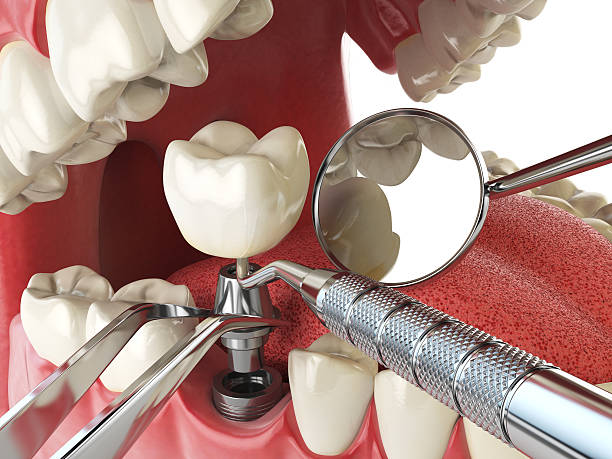 Best Walk-In Emergency Dentist in Columbus Junction, IA